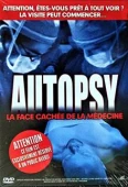 Pochette du film Autopsy : la Face Cachée de la Médecine